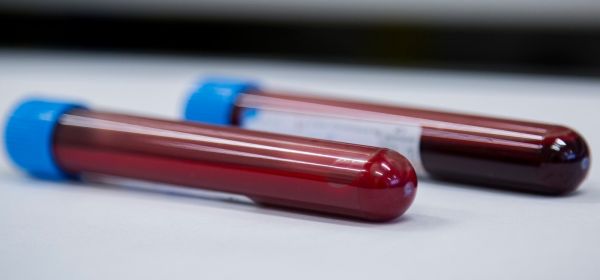 Bayer und Novo Nordisk feiern Comeback! BioNxt Solutions Aktie als N&auml;chstes?