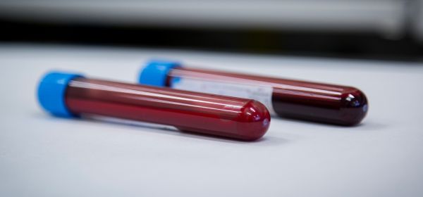 Gestern +10 %! Top-News treiben Aktien von Evotec, Novo Nordisk, Char Technologies!